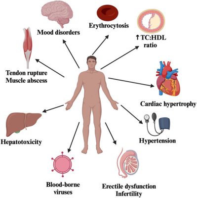 Winstrol Stanozolol 20mg